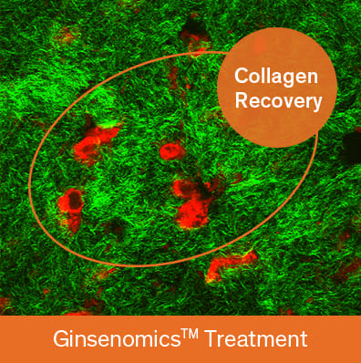Concentrated Ginseng Renewing Serum EX - The image shows the results of the collagen restoration artificial skin test.